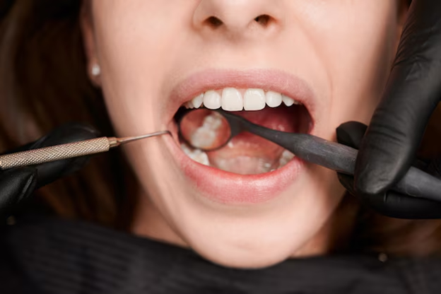 Cheap Temporary Tooth Filling in Abu Dhabi: What You Need to Know