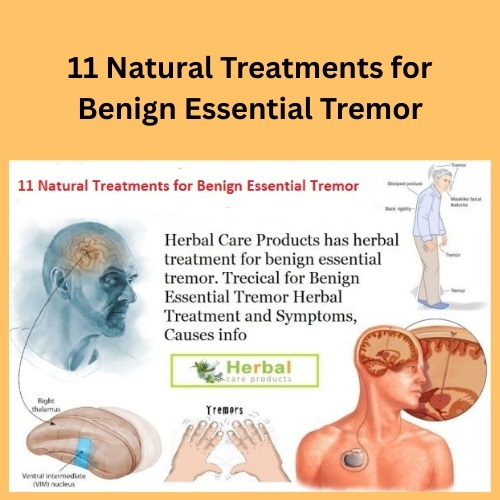 11 Natural Treatments for Benign Essential Tremor - Herbal Care Products - Blog