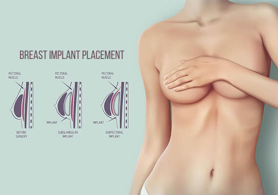 Performing Breast Augmentation Surgery with Dr. Priya Bansal will restore your confidence